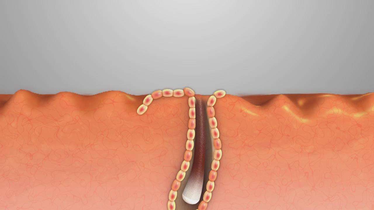 做唇有必要去角质吗,有没有必要去面部角质