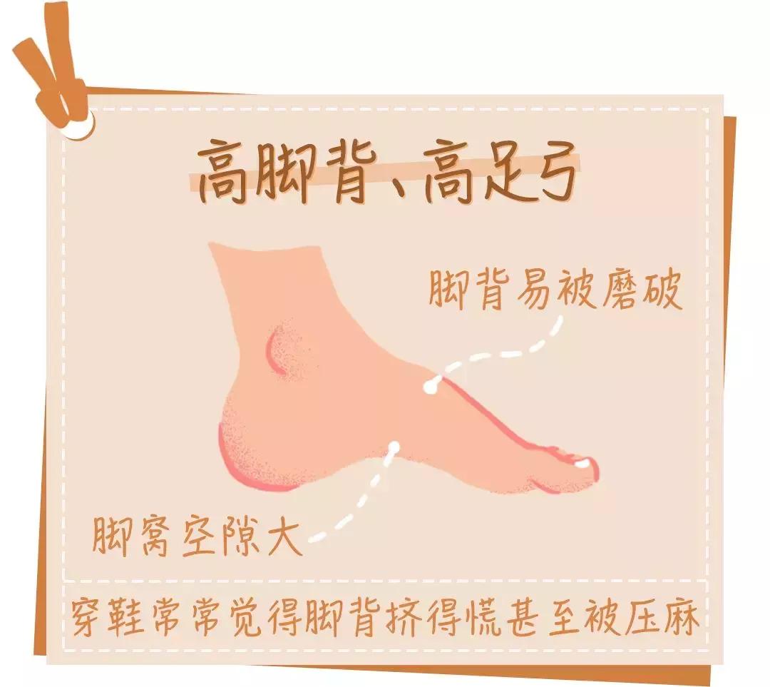 为什么穿鞋老磨脚,为什么鞋穿了一段时间又开始磨脚