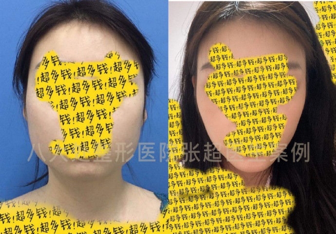 八大处张超抖音,八大处张超合集