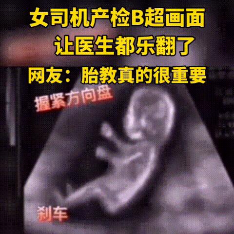 孕妇做b超胎儿在开车视频,b超胎儿开车
