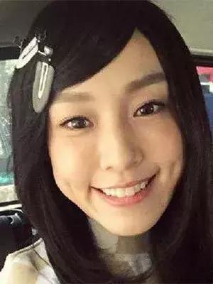 拯救发际线告别大额头,拯救发际线不走冤枉路