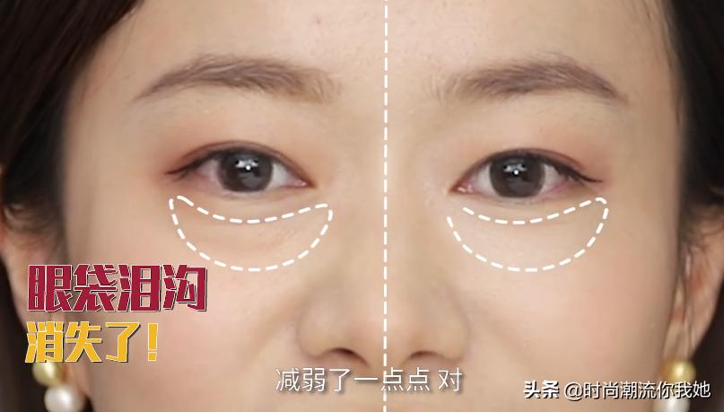 学会这些等于整容+修图！泪沟、眼袋、双下巴的超简单自救方案