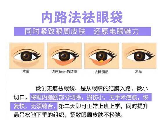 如何消除眼袋,如何消除眼袋泪沟的方法