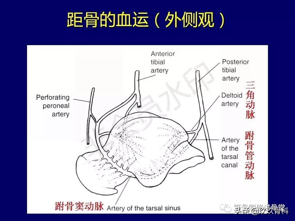 距骨骨折的治疗原则,距骨骨折如何调理