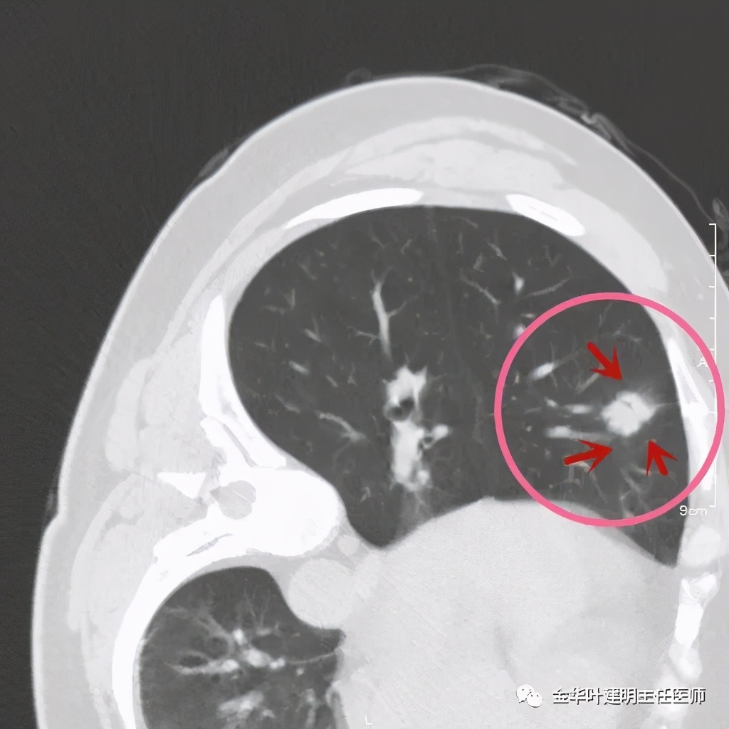 放个大招完整版教学,放个大招完整版前奏