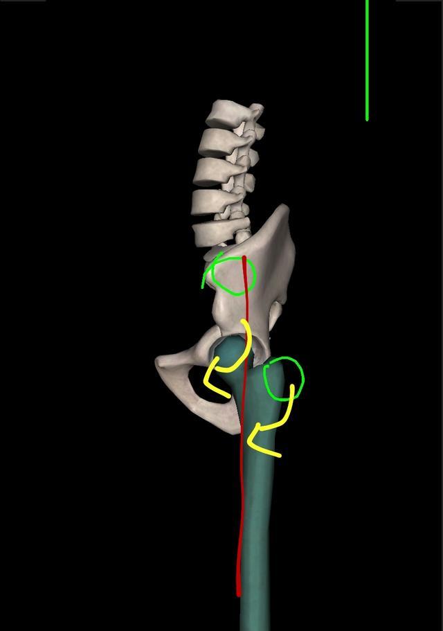胯宽了但腿型还是歪的矫正方法,怎样改变假胯宽和大腿内侧的肉