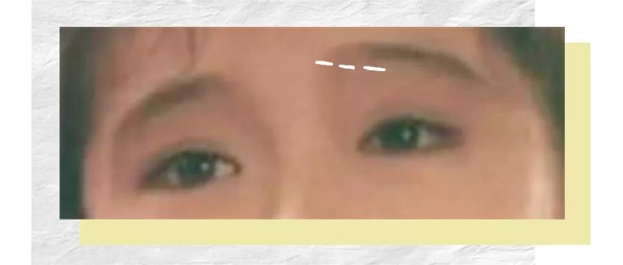 苦相怎么破,怎样避免苦相