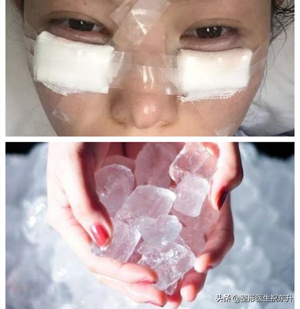 去眼袋的事情,关于祛眼袋手术这件事