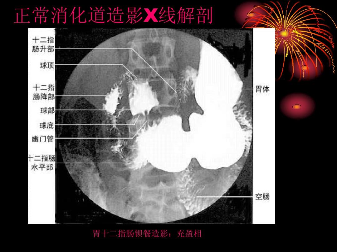 做胃镜和做胃ct哪个更准确,胃镜和胃部增强ct哪个比较准确