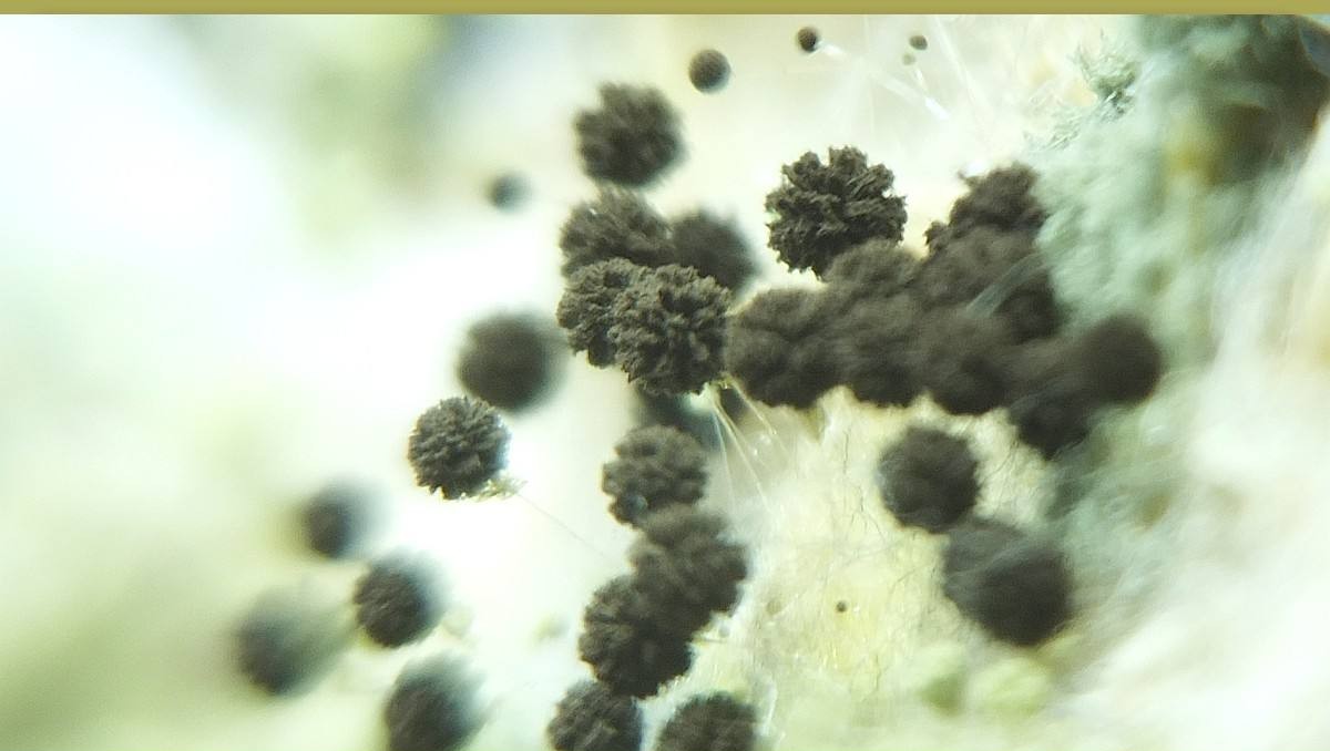 霉菌是什么病图片,霉菌是啥