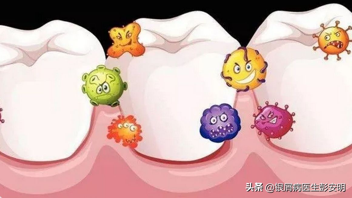 一根缝衣服的针，47岁男子拿来剔牙，剔出满头银屑病