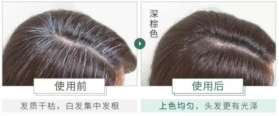 哪些护肤品代购是被炒出来的,日本药妆代购