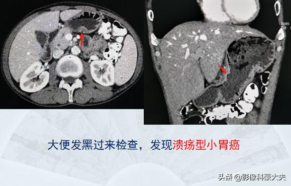 医圣张仲景,隔了1800年,用一盘饺子救了他