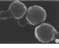 宝宝头垢不清理会有什么后果,婴儿头垢用手抠了咋办