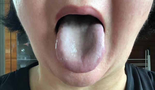 肾虚寒湿证的治法,肾虚湿热症用什么中药调理