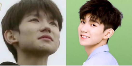 美摩仕祛痘膏效果好吗,美摩仕祛痘效果好吗