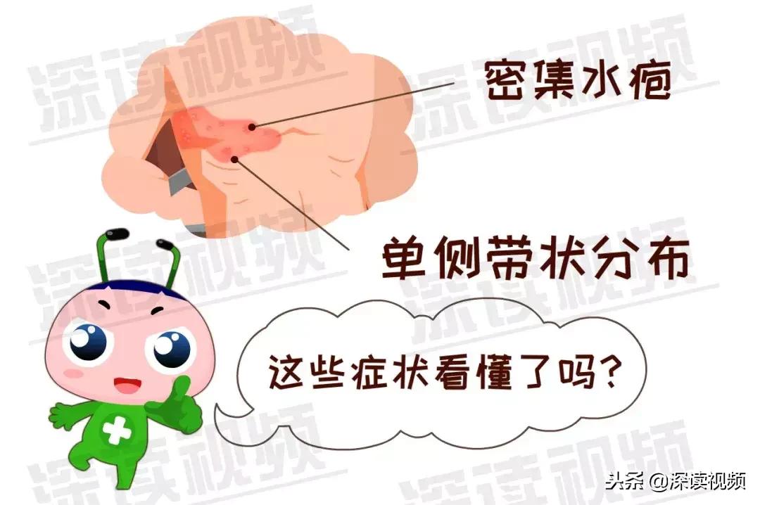 水痘和带状疱疹潜伏期是多久,得了水痘是不是容易得带状疱疹