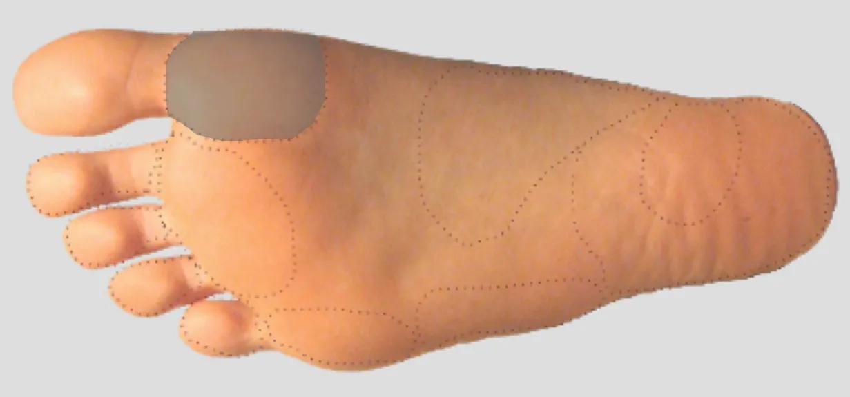 足踝外侧足底疼痛,内踝下方靠近足底的哪个位置痛