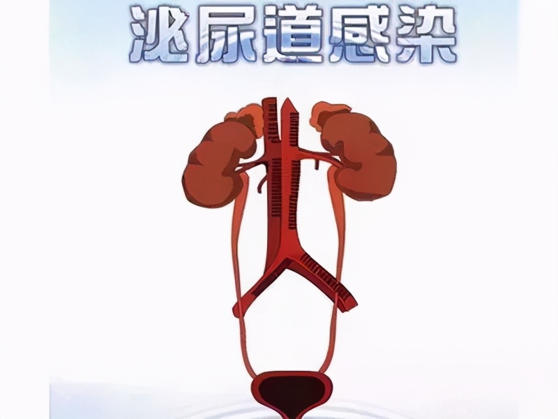 阴道炎会导致男性泌尿感染吗,男性夏季如何预防泌尿感染