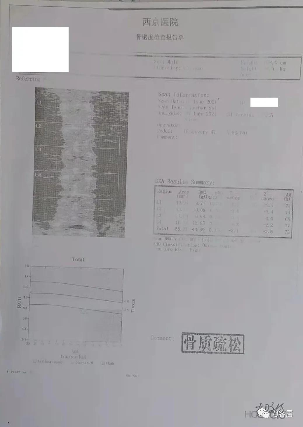 小针刀扎到坐骨神经会瘫痪吗,小针刀会切断坐骨神经吗