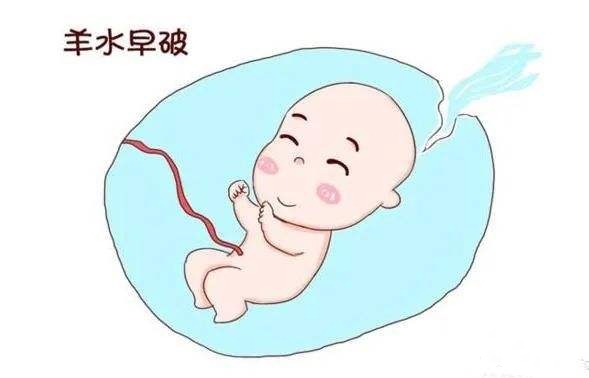 产妇脐带脱垂急救视频,产妇脐带脱垂医生全程托举救命