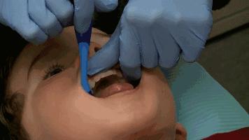 给孩子补个牙,竟花了两万多