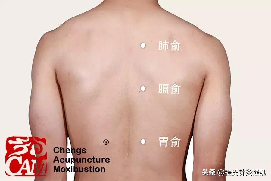 中医治疗顽固性呃逆,顽固性呃逆中药医案