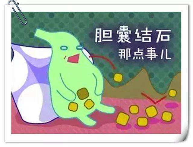 胆囊切除术后注意事项和饮食禁忌,微创胆囊切除手术出院后注意事项