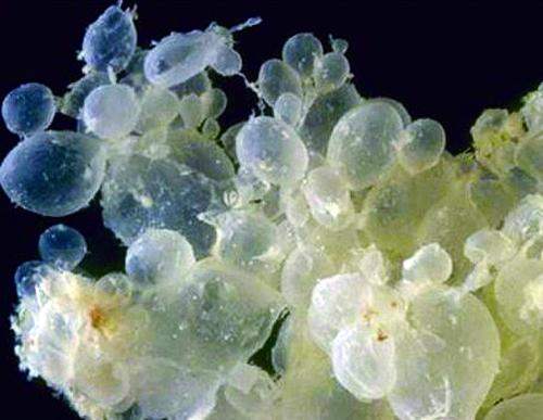 难道我的宝宝是葡萄?