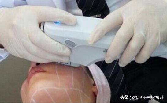 刚做完超声刀感觉脸有点肿正常吗,做完超声刀后脸肿了是正常现象吗