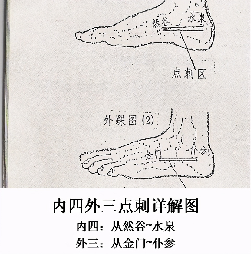 提高人体免疫力的穴位介绍（杜建华）