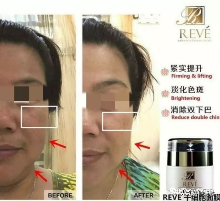 外泌体干细胞面膜真的有用吗,您还在为购买瓷砖交智商税吗