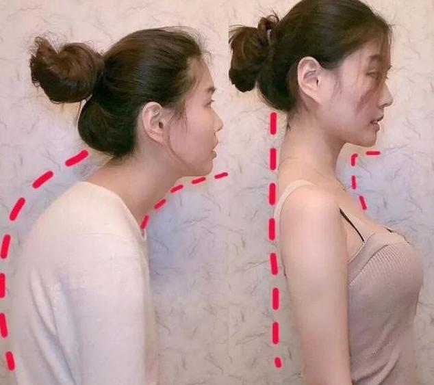 懒人纠正驼背的方法,改善圆肩驼背天鹅颈一字肩