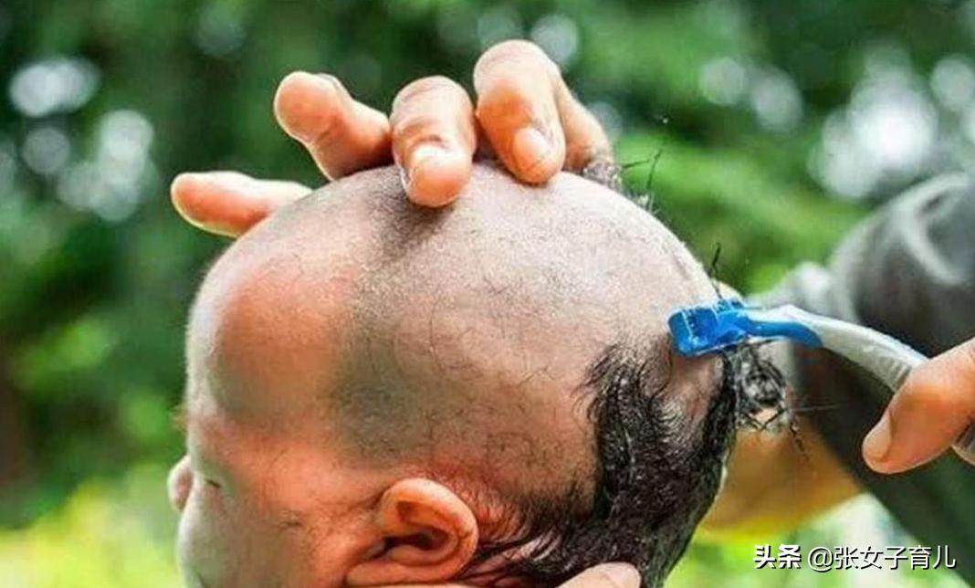 小宝宝头发稀少剃光头有用吗,小宝宝头发稀少可以剃光头吗