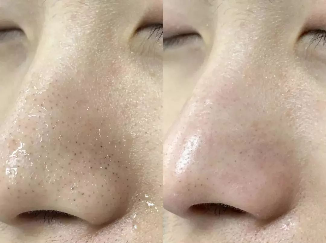 倪妮公认的高级脸照片,倪妮高级脸还可以撑多久