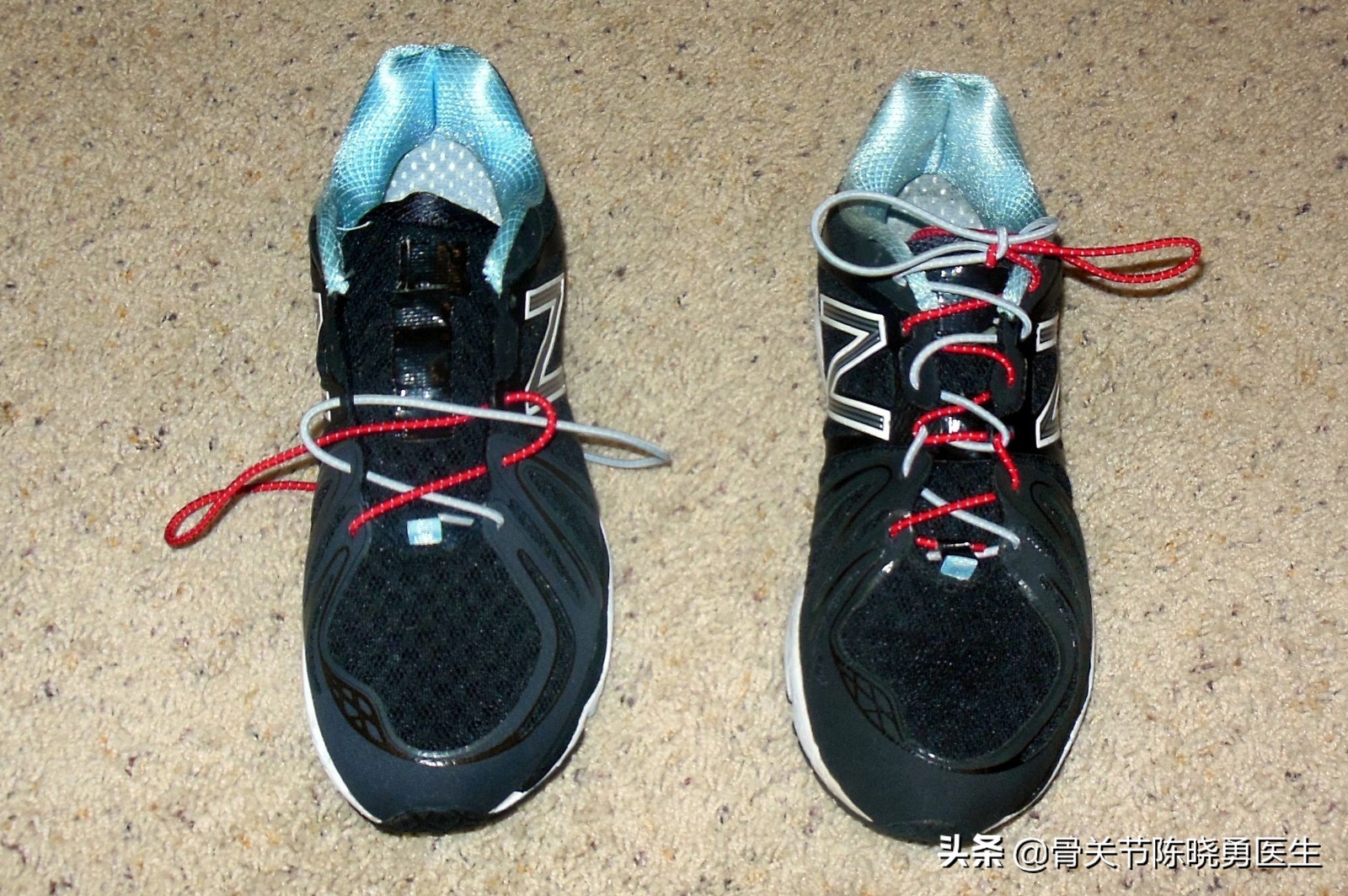 腰间盘突出跑步一跑就脚麻,跑步的时候脚麻是怎么回事