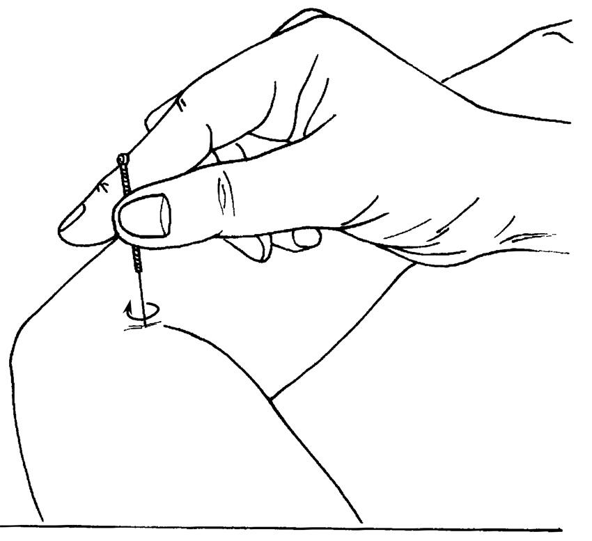 中医针灸四大名赋,针灸必背歌赋之百症赋2