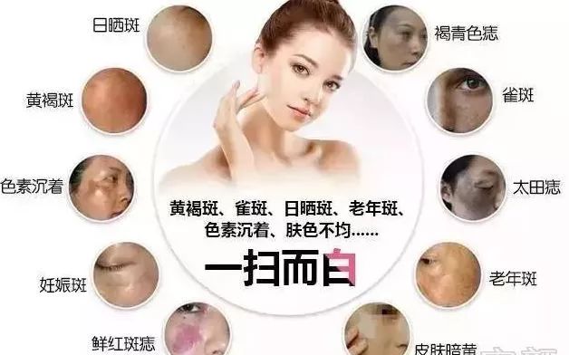 传说中效果倍儿好的超皮秒祛斑，真的这么神奇吗？