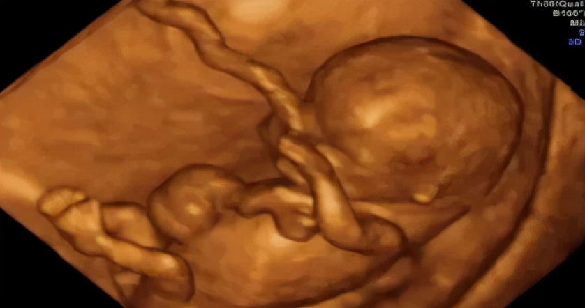 孕期超声检查须知,准妈妈必读产前超声小课堂