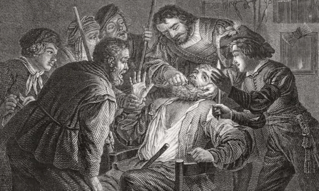 以前是怎么拔牙的,以前拔牙怎么拔的