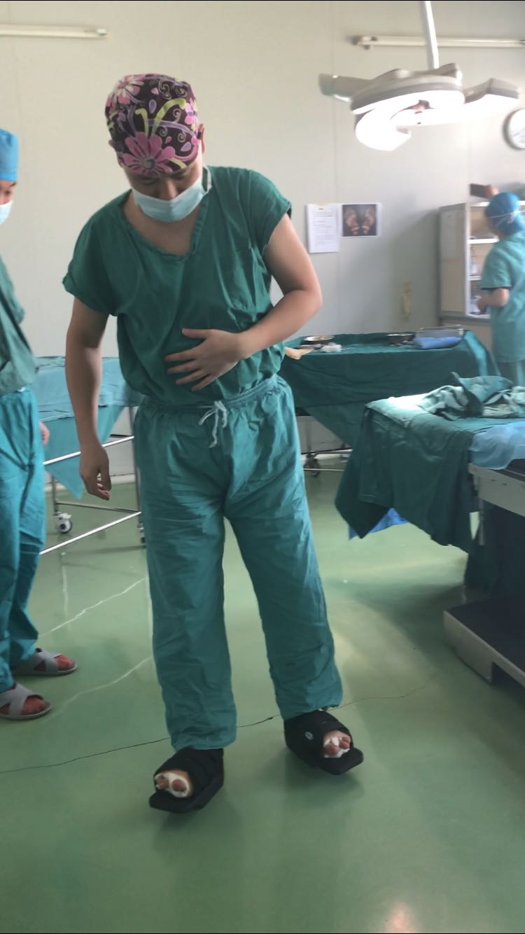 拇外翻微创手术的全过程,医生自己给自己做拇外翻手术