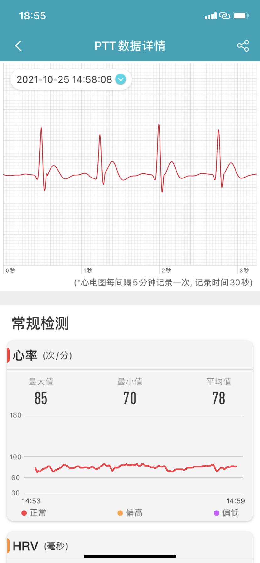 dido老年人手环,dido手表手环