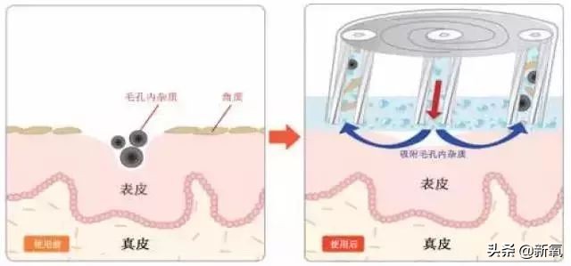 家用美容仪怎么选适合自己的,简单实用美容仪