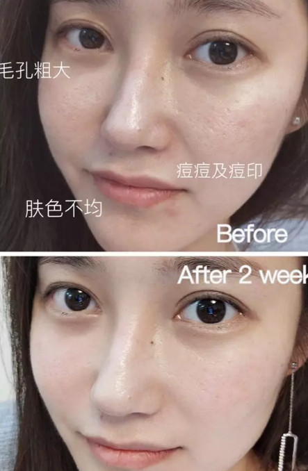 孙艺珍的颜值变化,孙艺珍颜值巅峰的笑容