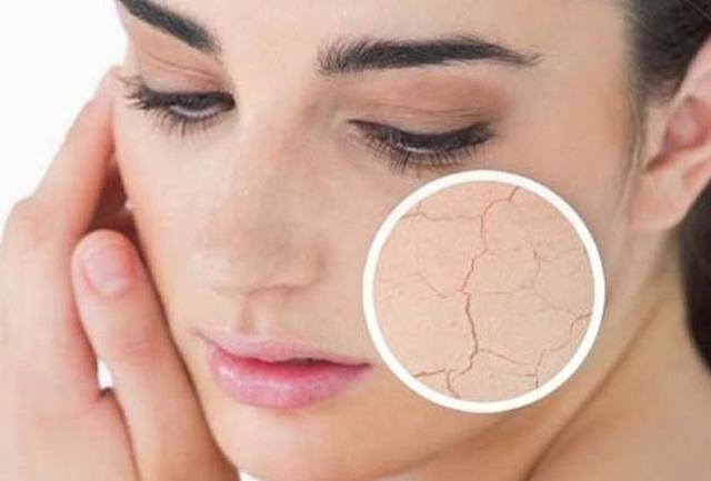 防止开空调过度干燥,开空调干燥要怎样保湿