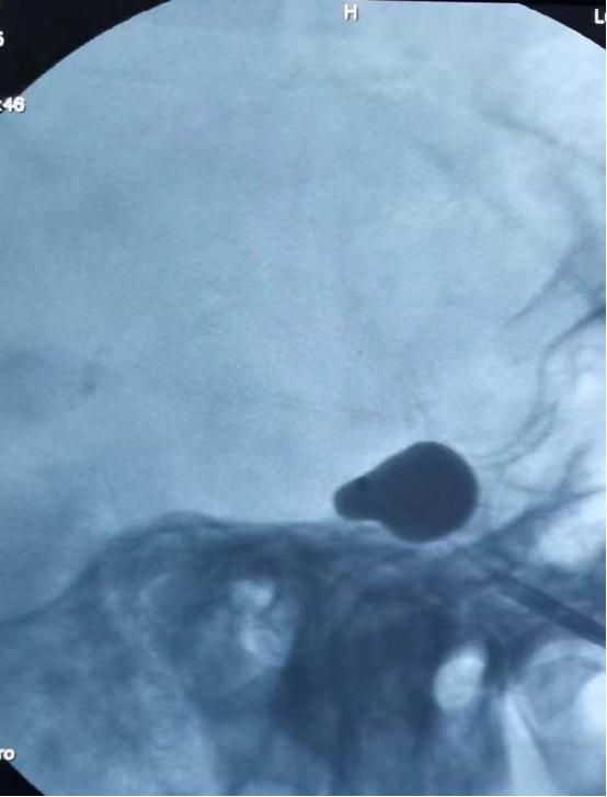 合肥华安脑科康复医院,合肥华安脑科医院