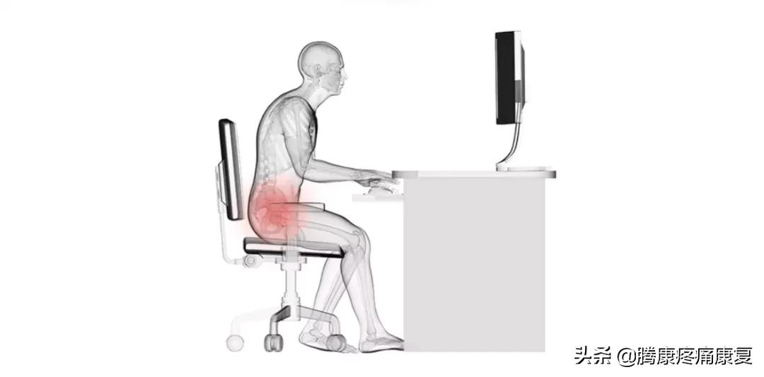 怎么解决下交叉综合症,下交叉综合征改善训练