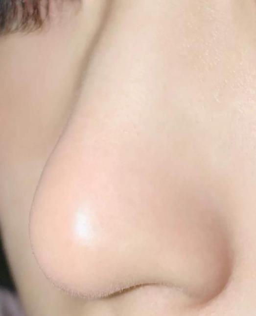 卸妆油对付黑头,家里卸妆产品用完了能用什么卸妆