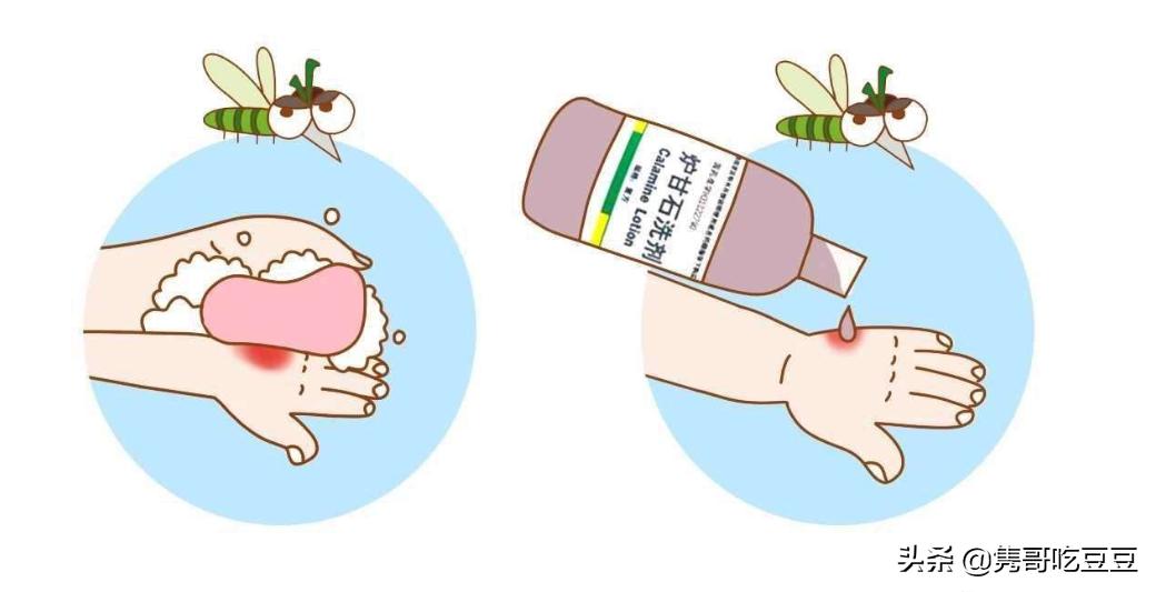 小宝宝被蚊子咬了怎么处理好一点,宝宝被蚊子咬了的处理方法