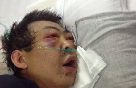 江苏化工厂苯爆炸，“苯”到底有多可怕，面对苯中毒我们如何自救？